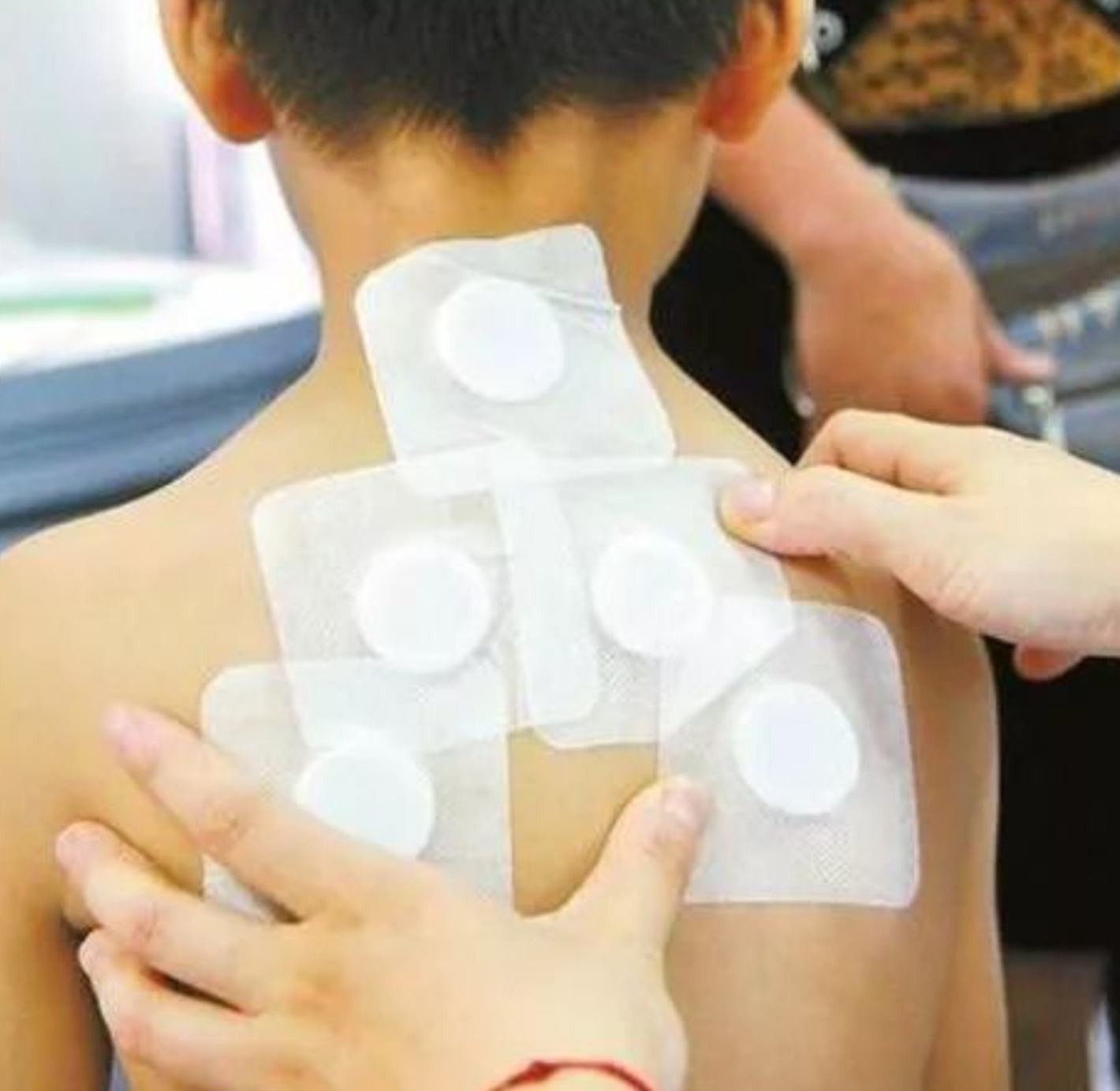 2、三伏貼在脖子上，有一根針，看起來很疼。怎么了